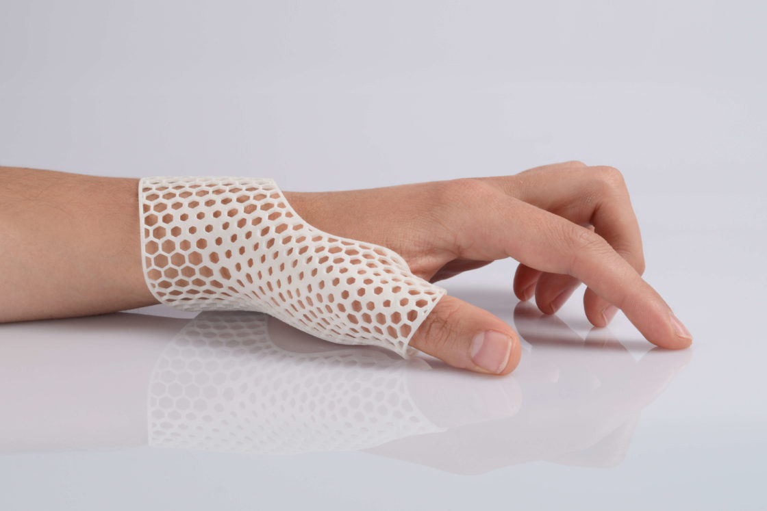 PA11-SLS-White-HandOrthosis-EOS-3Dprinting-Blog