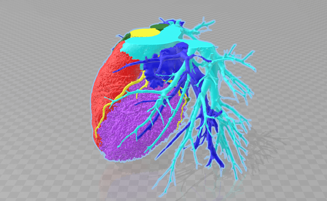 ComputerImage-3Dprinting-HumanHeart-ArmorBionics-Blog